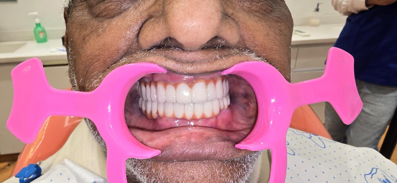 Patient smile after treatment at Ritual Dentistry