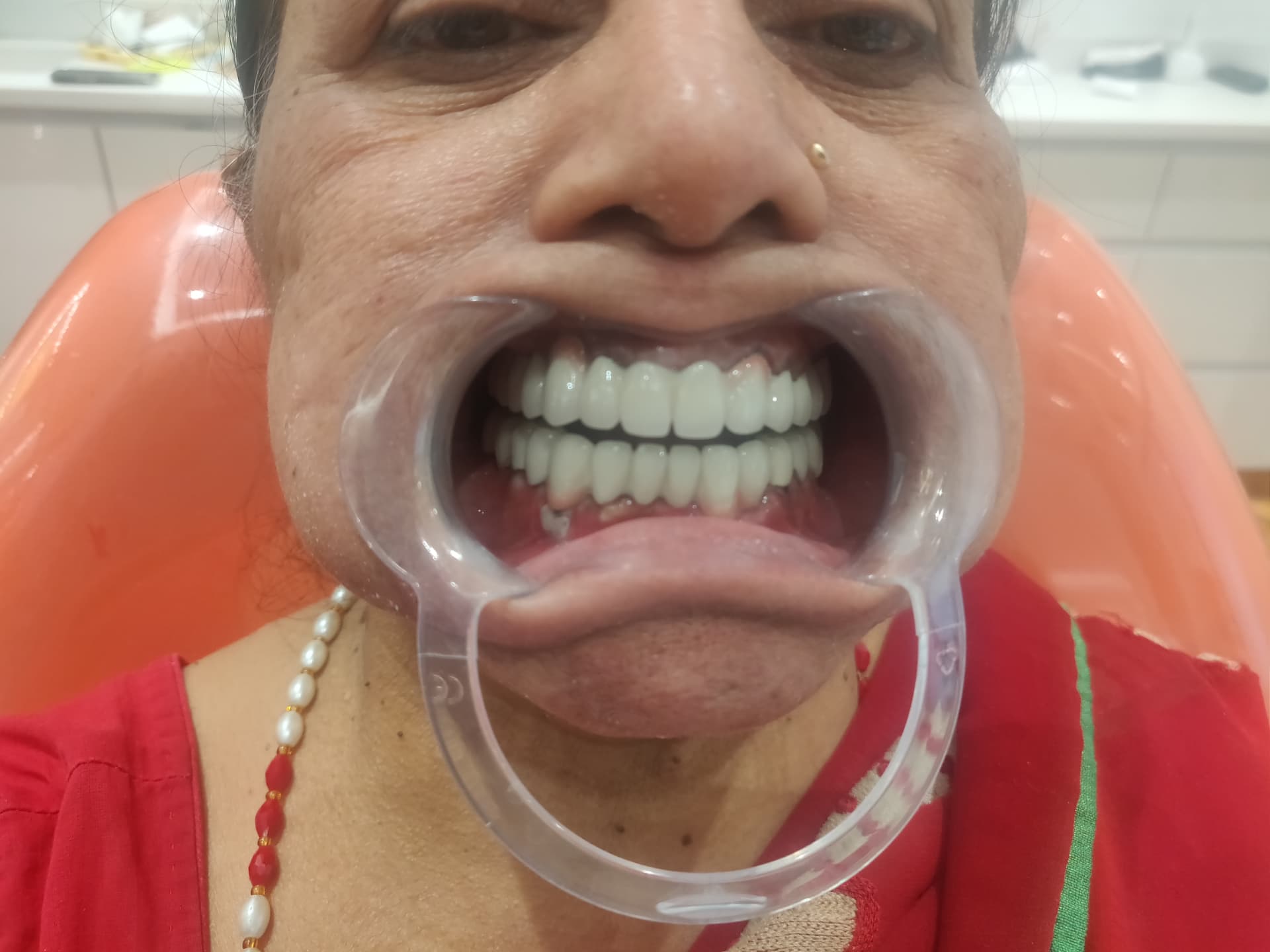 Patient smile after treatment at Ritual Dentistry