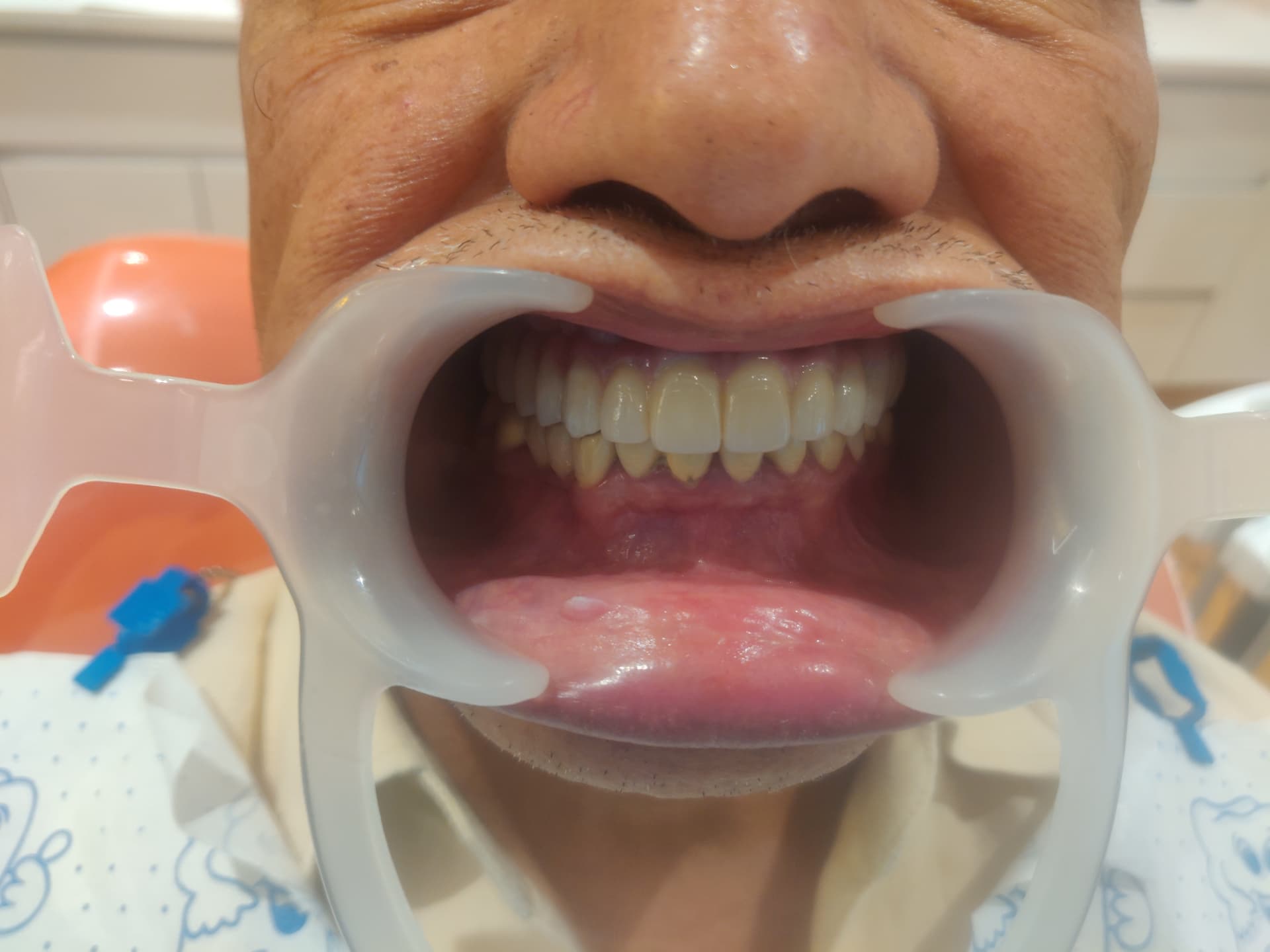 Patient smile after treatment at Ritual Dentistry