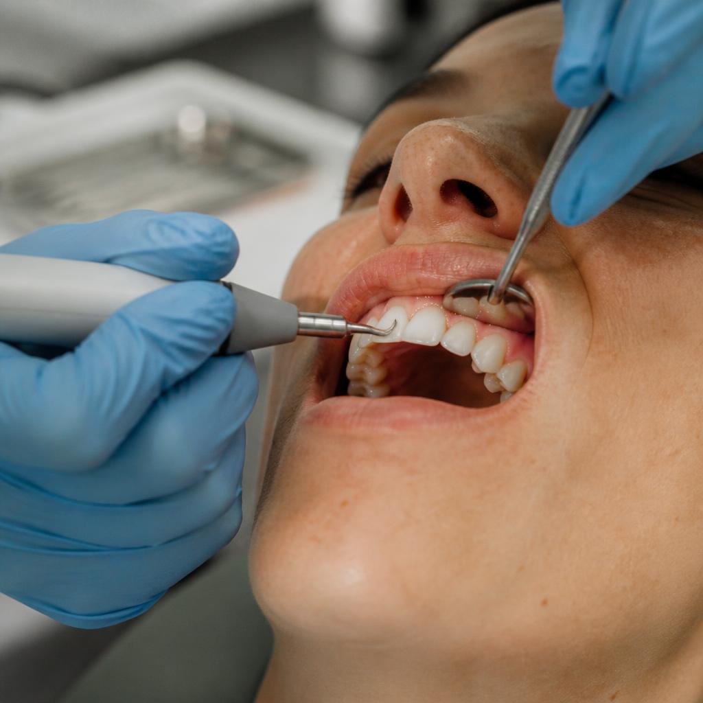 Gum Treatment